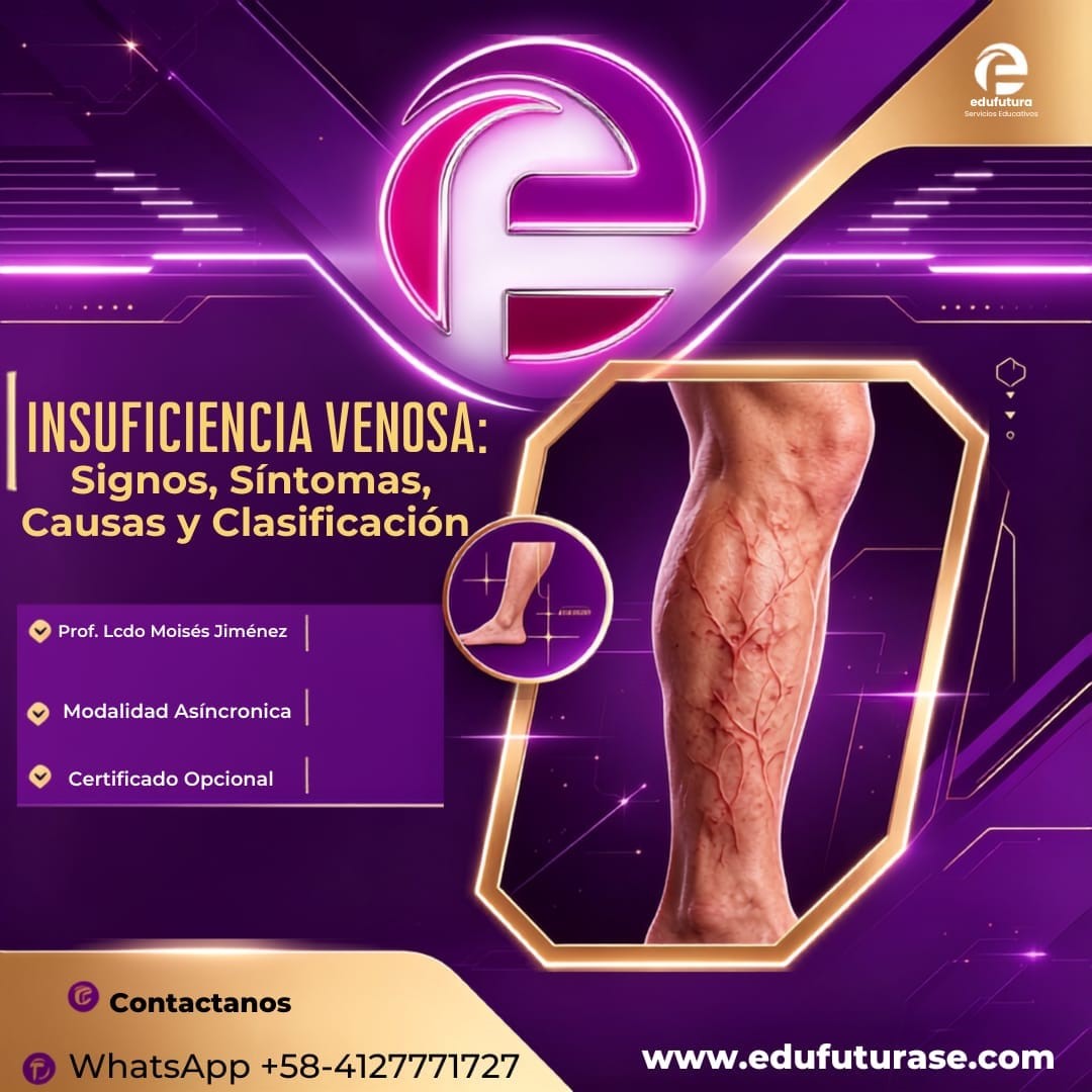 Insuficiencia Venosa: Signos, Síntomas, Causas y Clasificación